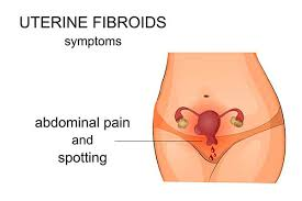 12-24 Week Fibroid Healing Coaching Program
